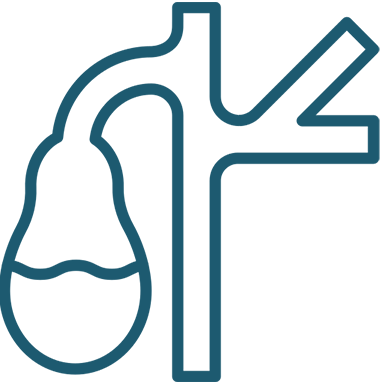 Lithiase Vesiculaire